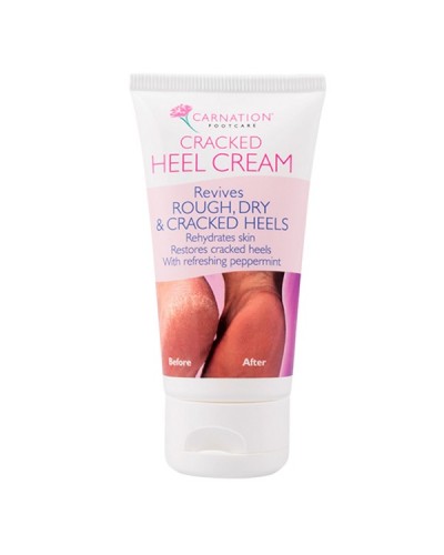 CARNATION CRACKED HEEL CREAM 50ml