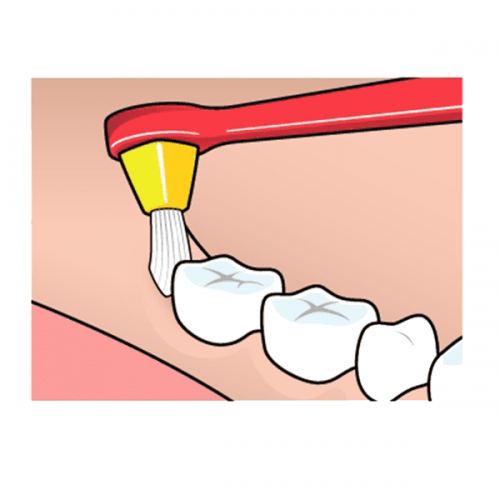 TEPE INTERSPACE TOOTHBRUSH MEDIUM & 12 TIPS