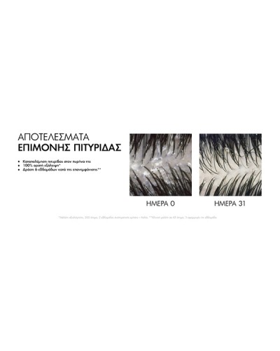 VICHY DERCOS ANTI-DANDRUFF ΑΝΤΙΠΙΤΥΡΙΔΙΚΟ ΣΑΜΠΟΥΑΝ ΓΙΑ ΚΑΝΟΝΙΚΑ & ΛΙΠΑΡΑ ΜΑΛΛΙΑ 390ml